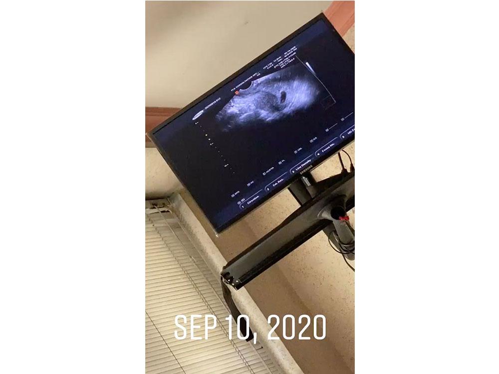 A bun in the oven!