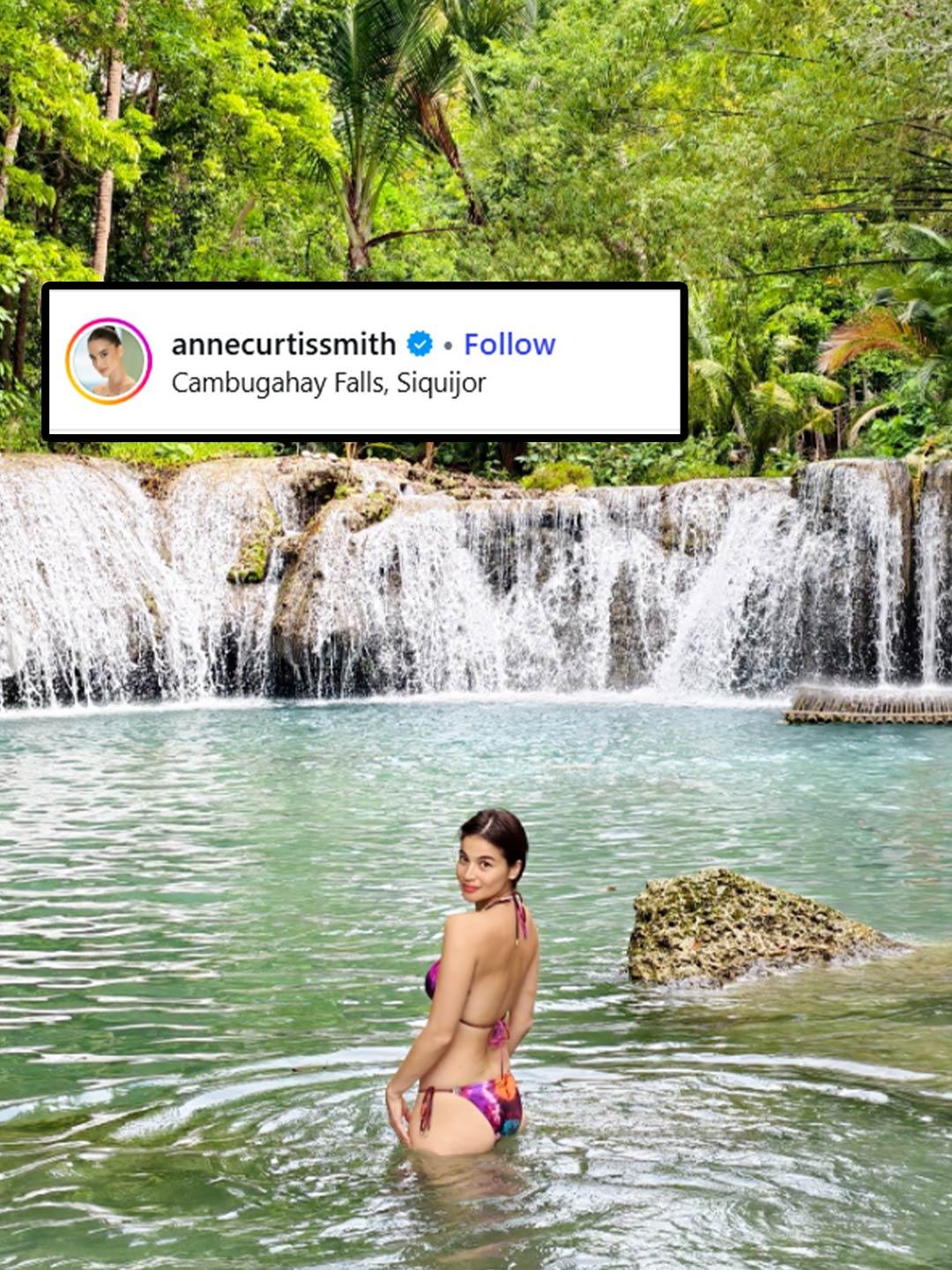 Anne Curtis