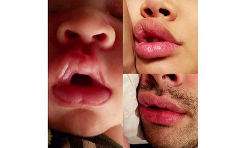 Lips