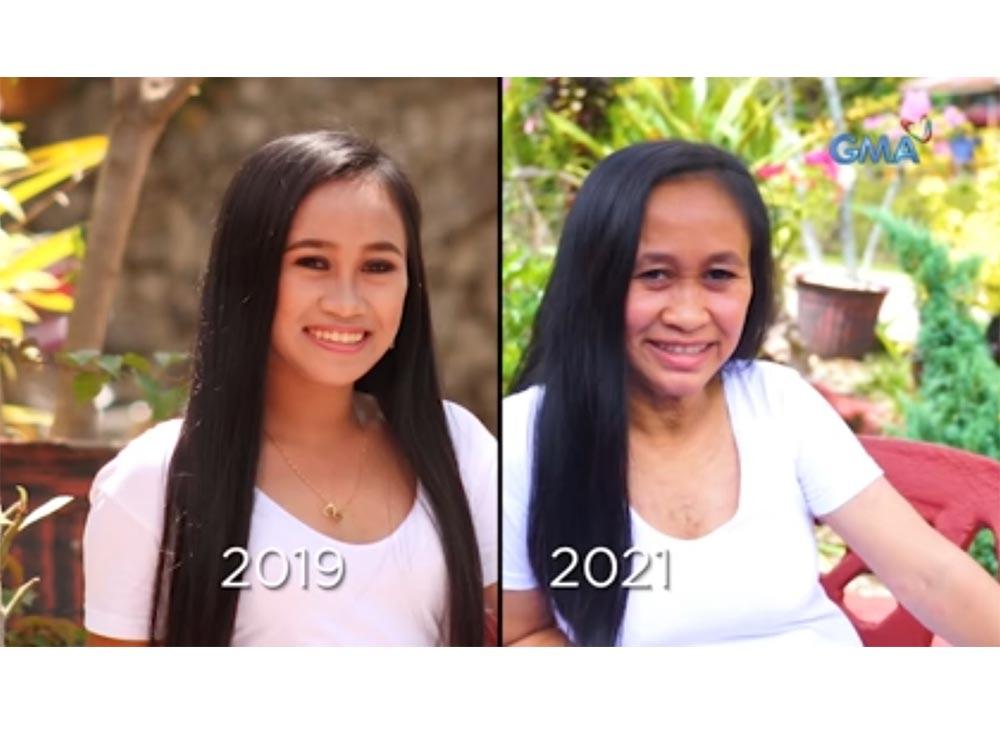 16-anyos na dalaga, nagmukha na raw 50-anyos