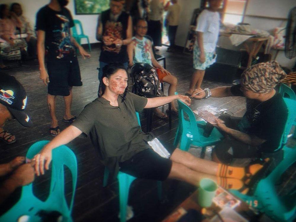 Meryll in prosthetics