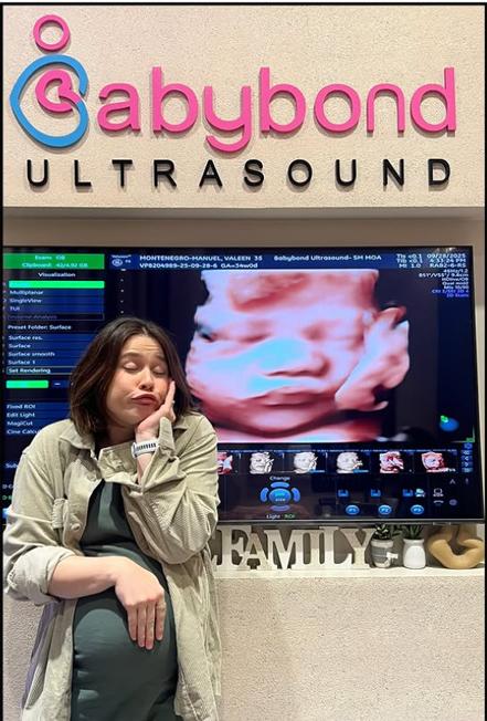 Ultrasound