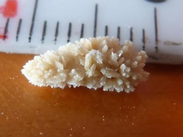 Image Source: Pinoy MD