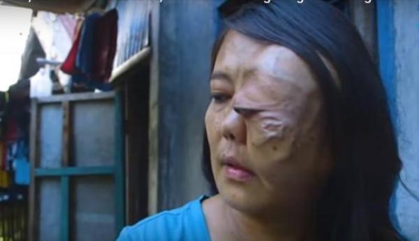 KMJS: Namamagang mukha ni Ritchelle Bernal, dahil sa contact lens?