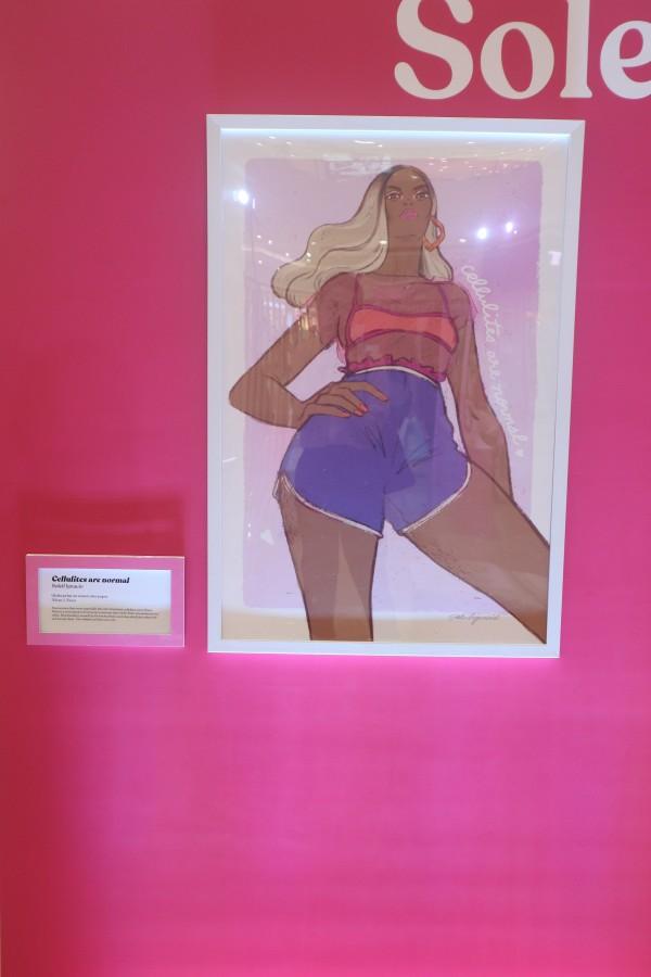 Cellulites are normal by Soleil Ignacio