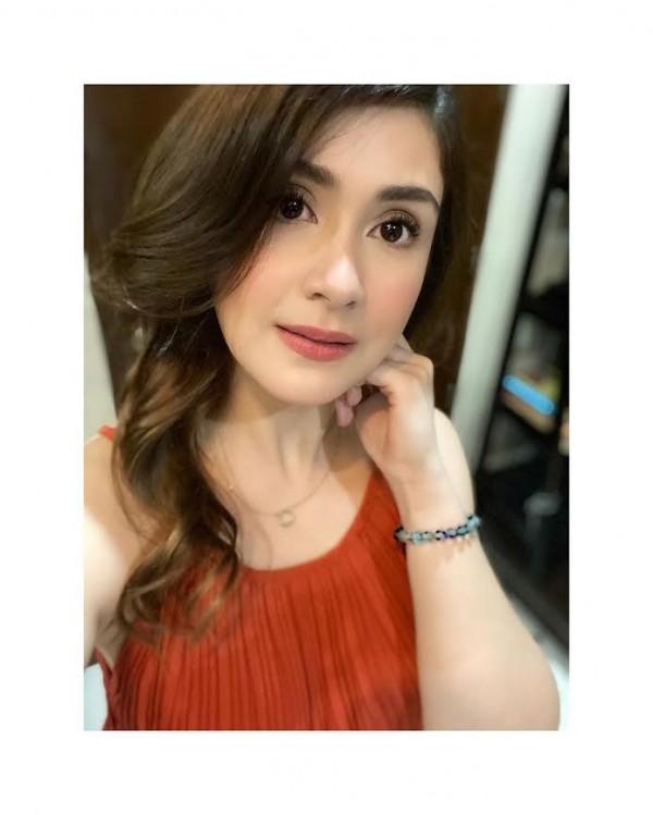 Carla Abellana