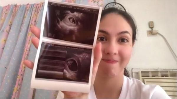 Vaness del Moral holding her sonogram