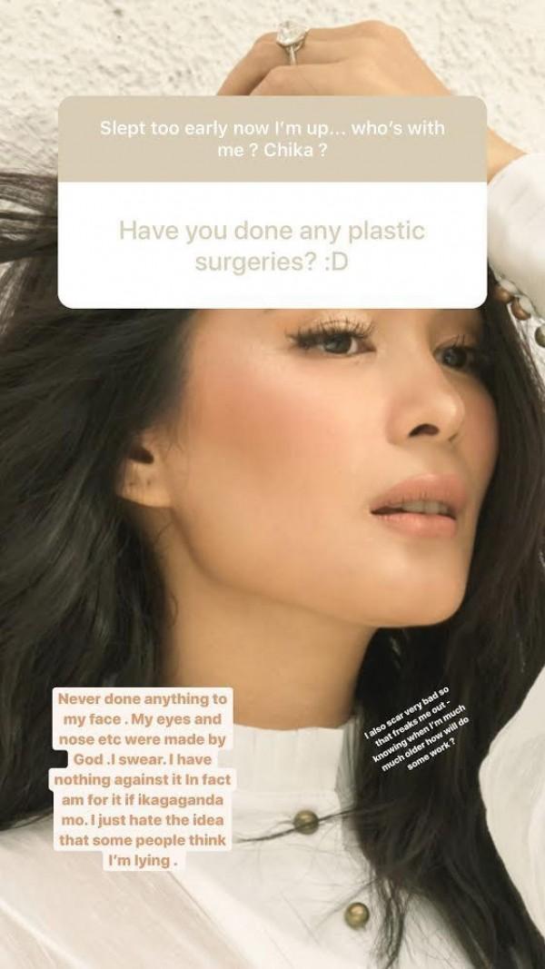 Heart Evangelista Didn't Have Cosmetic Surgery On Her Face 