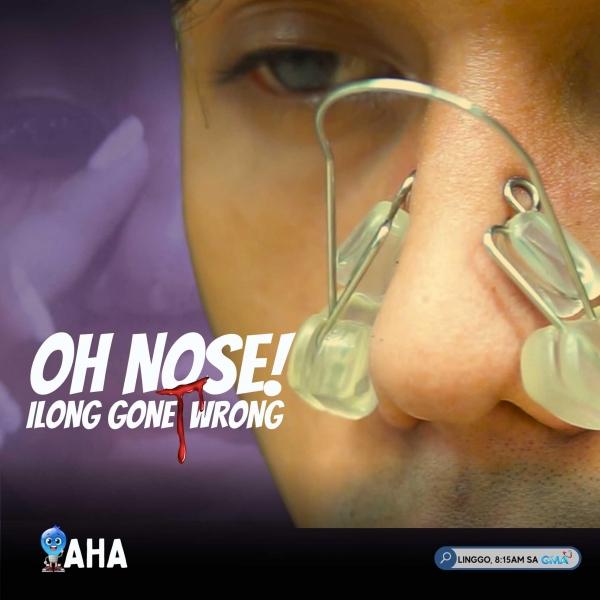 Oh Nose Ilong Gone Wrong