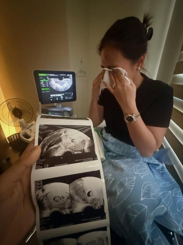 Arny Ross Franklin Banogon