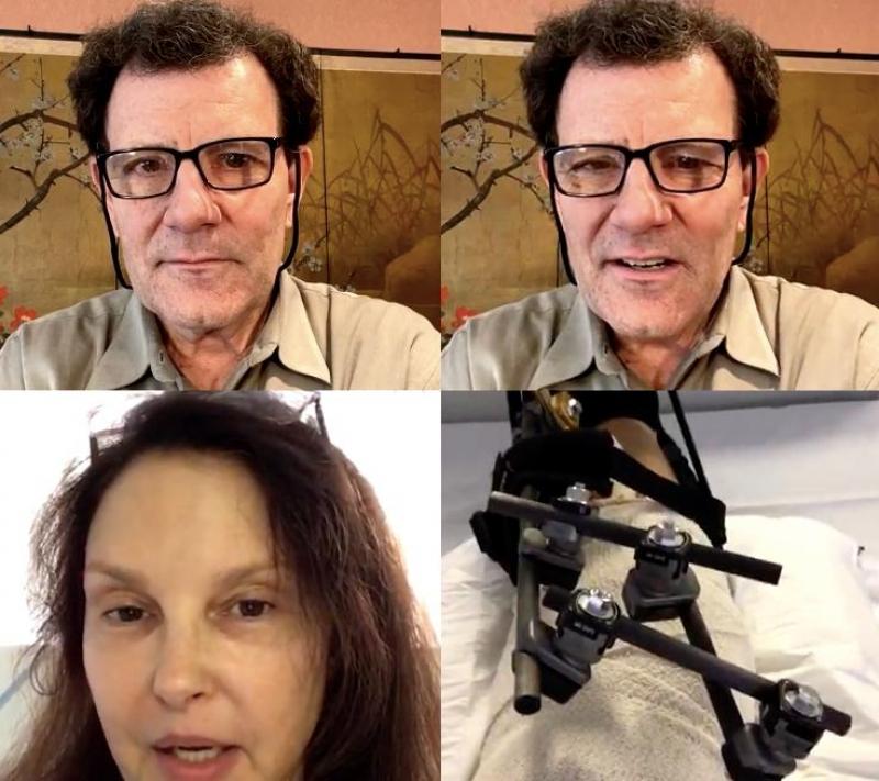 ashley shows external fixator