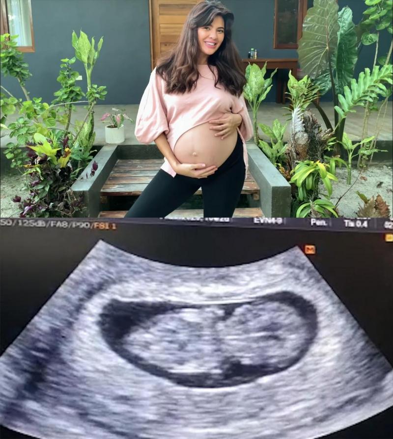 katarina rodriguez and sonogram