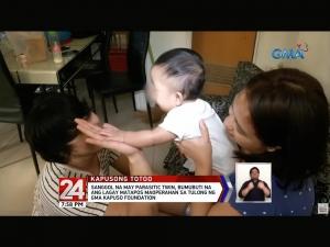 GMA Kapuso Foundation helps Baby Ned