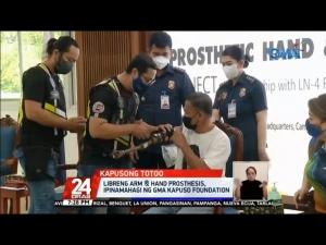 Hand and arm prosthesis